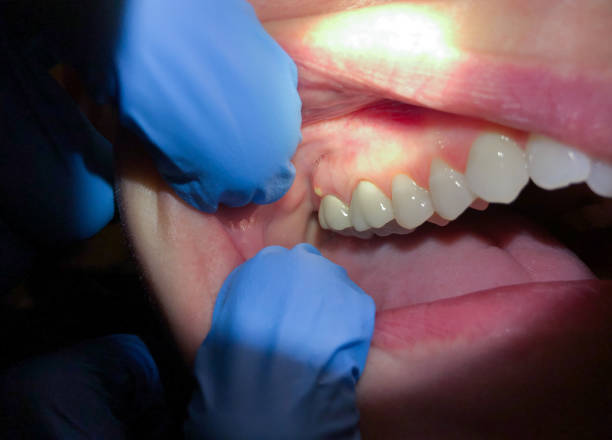 Best Emergency Dental Surgery in Bunker Hl, IL