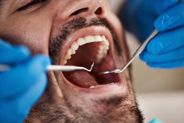 Best Walk-In Emergency Dentist in Bunker Hl, IL