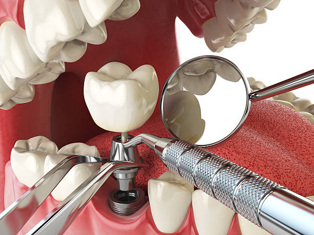 Best After-Hours Emergency Dentist in Bunker Hl, IL